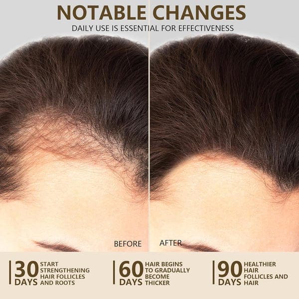 Hair before and after results best oil in Dubai