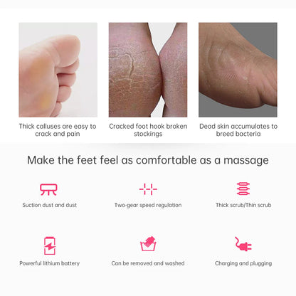 Electric Callus Remover | Portable rechargeable| For smooth soft feet .